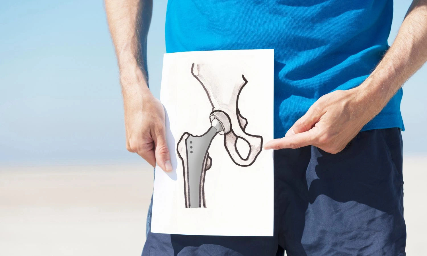 Best hip replacement surgeon in Ghaziabad with years of expertise showing Hip Image